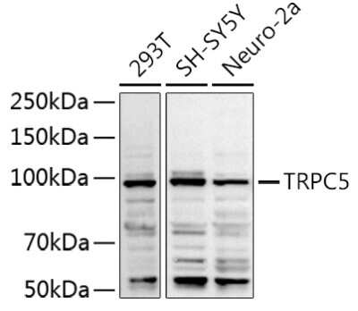 Western Blot TRPC5 Antibody - Azide and BSA Free